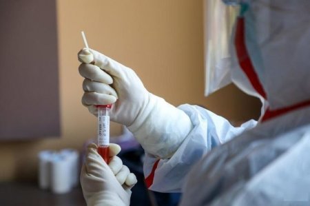 Naxçıvanda 71 nəfərdə koronavirus aşkarlandı: Ölən var