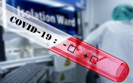 Azərbaycanda daha 44 nəfərdə koronavirus aşkarlandı - 1 nəfər vəfat etdi, 74 nəfər sağaldı