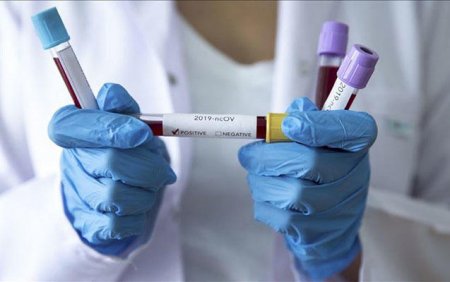 Azərbaycanda daha 143 nəfər koronavirusa yoluxub - 3 nəfər ölüb, 44 nəfər sağalıb