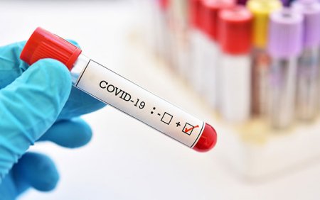 Azərbaycanda daha 230 nəfər koronavirusa yoluxdu - 103 pasiyent sağaldı, ikisi vəfat etdi