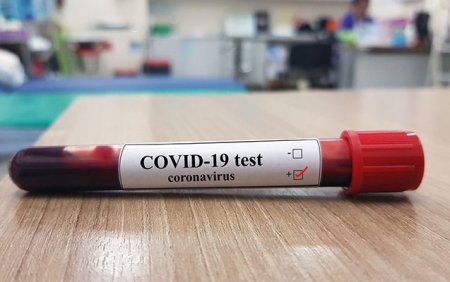 Daha 315 nəfərdə koronavirus aşkarlandı - 5 nəfər vəfat etdi