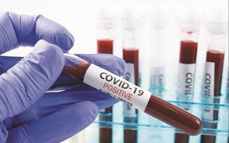 Azərbaycanda daha 329 nəfər koronavirusa yoluxub, 7 nəfər ölüb