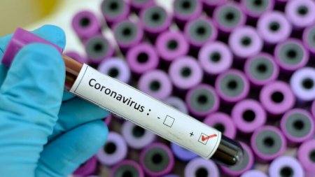 Azərbaycanda 547 koronavirusa yoluxma - 6 ölü