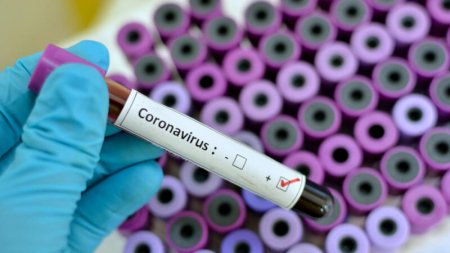 Daha bir TV-nin 8 əməkdaşında koronavirus aşkarlandı