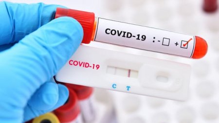 Gürcüstanda koronavirusa yoluxanların sayı kəskin artdı