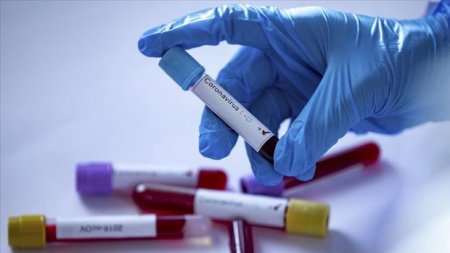 Azərbaycanda daha 339 nəfər koronavirusa yoluxdu: 114 nəfər sağaldı, 4 nəfər öldü