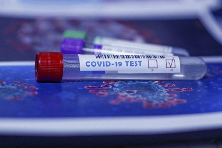 Daha 471 yeni koronavirusa yoluxdu - 7 ölü